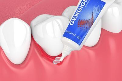 Sada na péči o zuby s rovnátky GENGIGEL gel + OROXID sensitiv sprej - 4