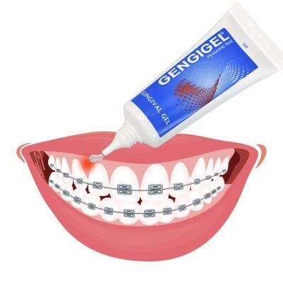 Sada na péči o zuby s rovnátky GENGIGEL gel + OROXID sensitiv sprej - 5