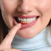 Zánět dásní a parodontóza